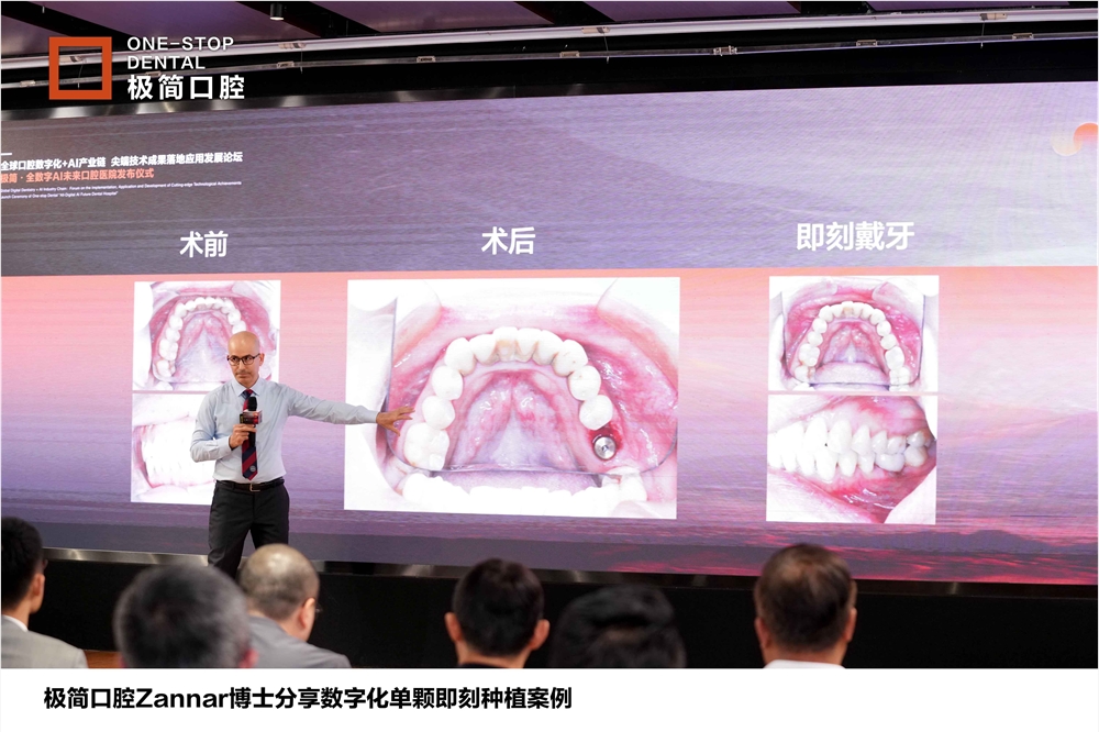 极简口腔黑科技3分钟种牙 当天戴牙快准舒适新体验插图3