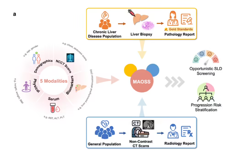 阿里达摩院发布 MAOSS 模型：利用 AI 筛查脂肪肝，高风险检出率翻倍