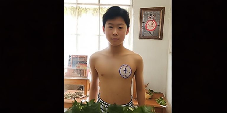 初二男生贴助长贴一年长高11厘米 中医揭秘助生长秘诀