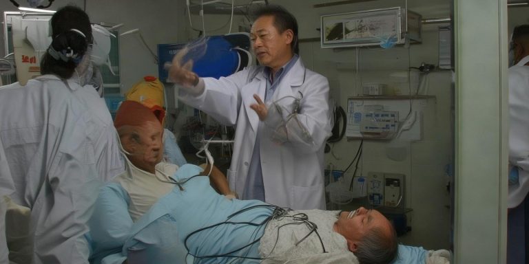 大爷生吞草鱼鱼胆中毒进ICU 医生紧急提醒危险后果